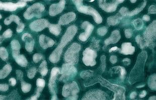 microscope_h5n1virus