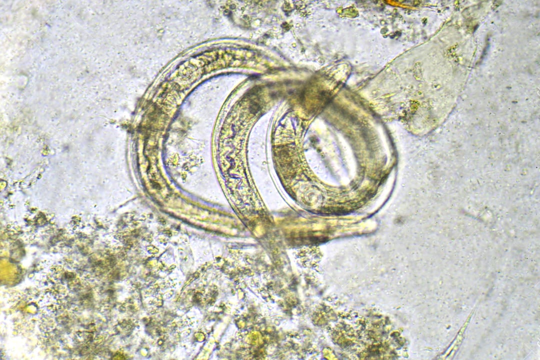 Strongyloides stercoralis. Threadworm in stool.